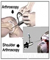 arthroscopy-sports4966.jpg