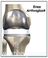 knee-arthroplast4965.jpg